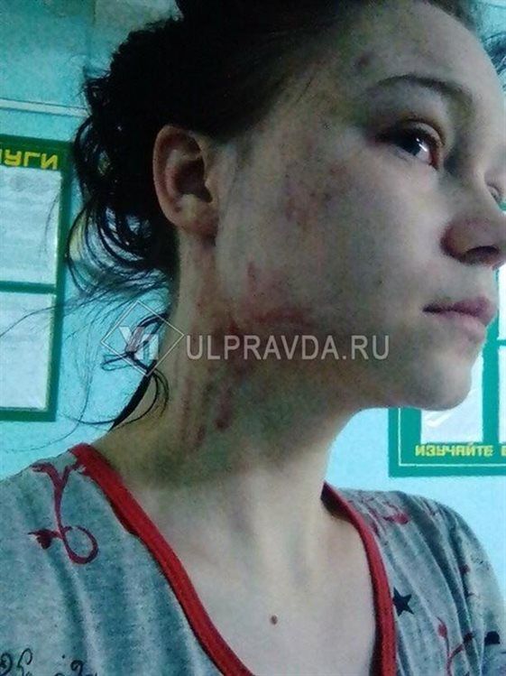Девушка обвинила анестезиолога в избиении, после чего сама оказалась за решеткой