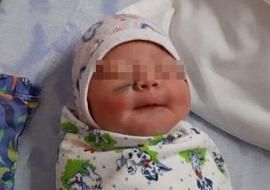 Новорожденной при родах врачи-акушеры разрезали скальпелем щеку