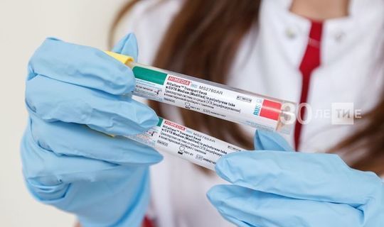 В Татарстане за сутки выявлено 85 новых случаев коронавируса