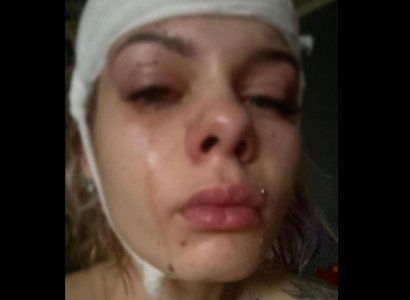 23-летнюю девушку жестоко избили на вечеринке